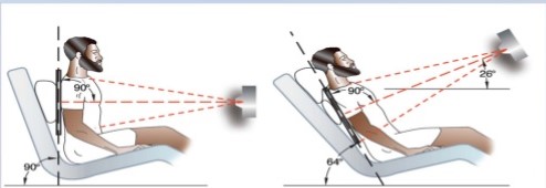 Posicionamiento del paciente con equipo de rayos X portátil